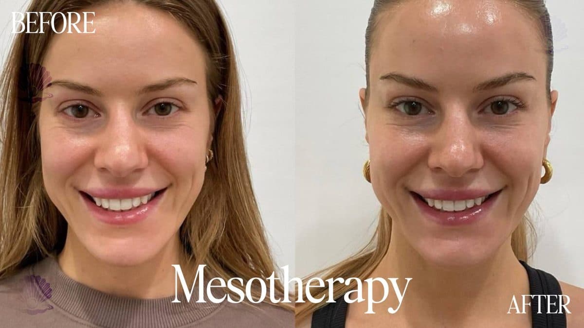 Face — overall skin quality