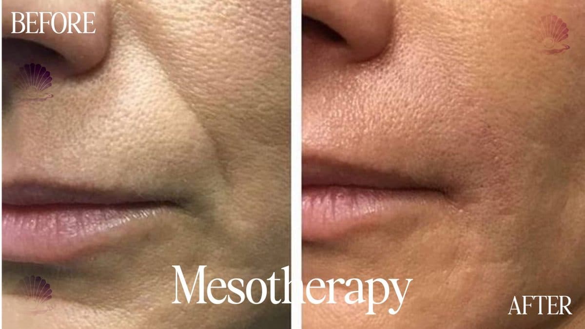 Face — texture & hydration