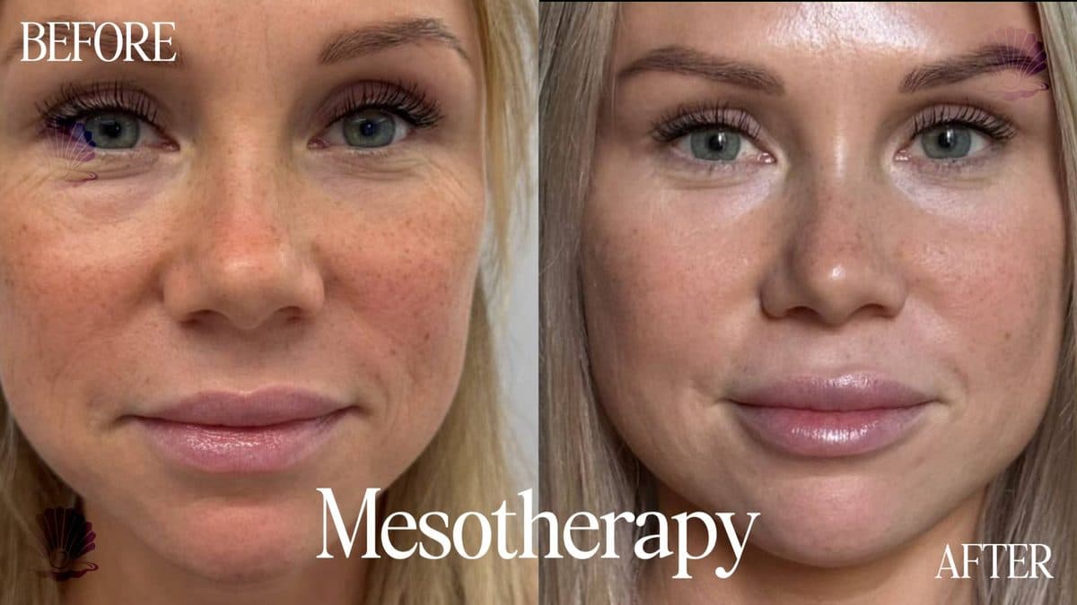 Face — tone & glow
