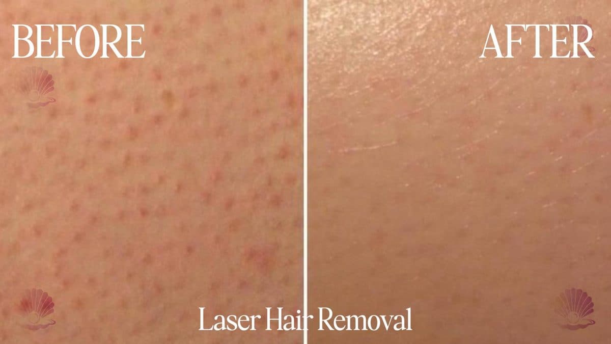 Skin — close-up
