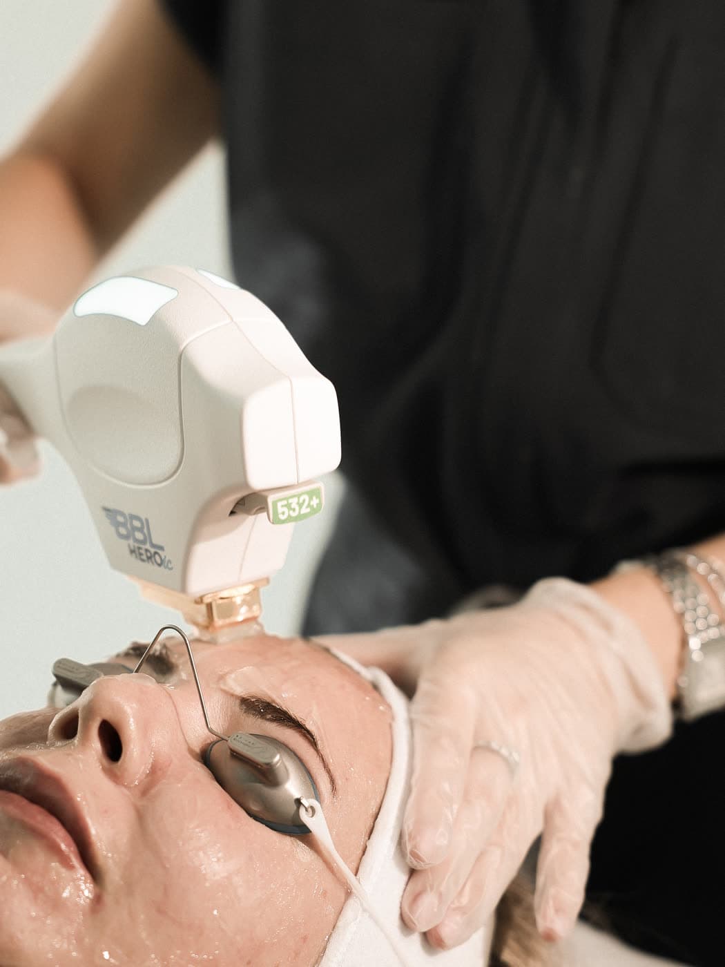 Pigmentation treatment approach at Pearl Skin Polyclinic