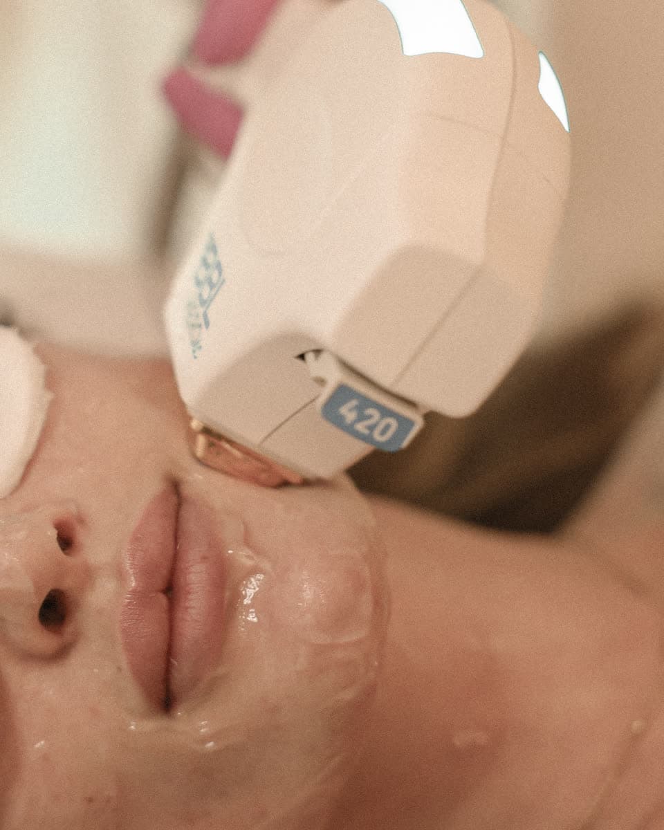 Vascular & Redness treatment approach at Pearl Skin Polyclinic