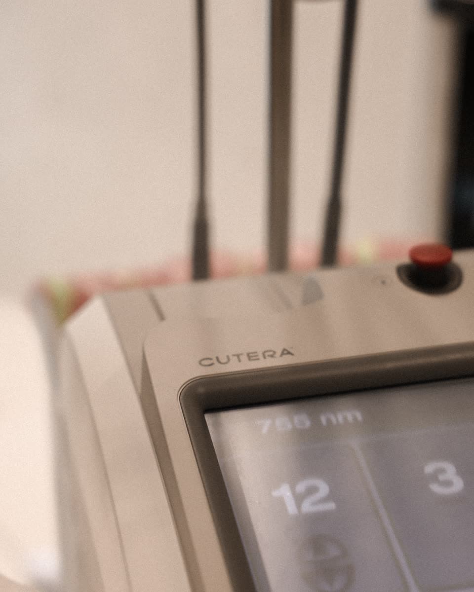 Cutera laser (vascular)